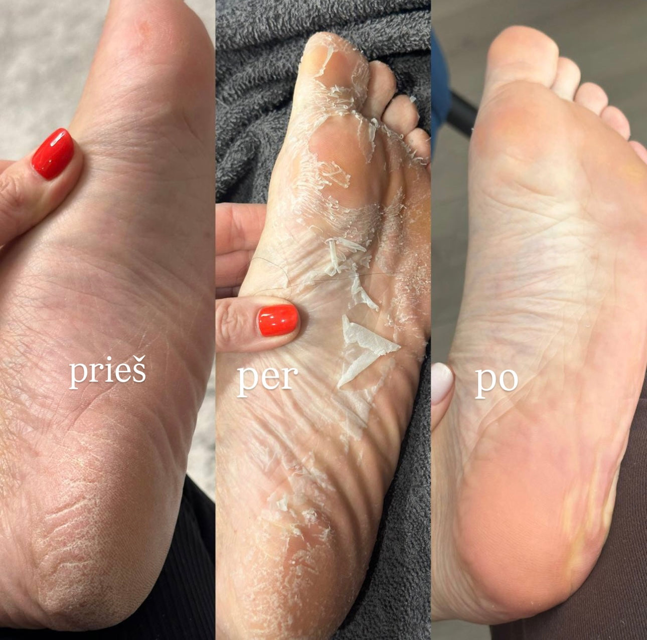 Korėjietiška MONSTER šveičiamoji pėdų kaukė CHAMOS ACACI