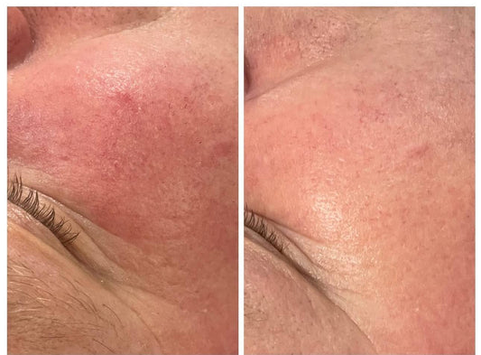 YVETTE Alpin Rose kapiliarus stiprinantis dieninis kremas