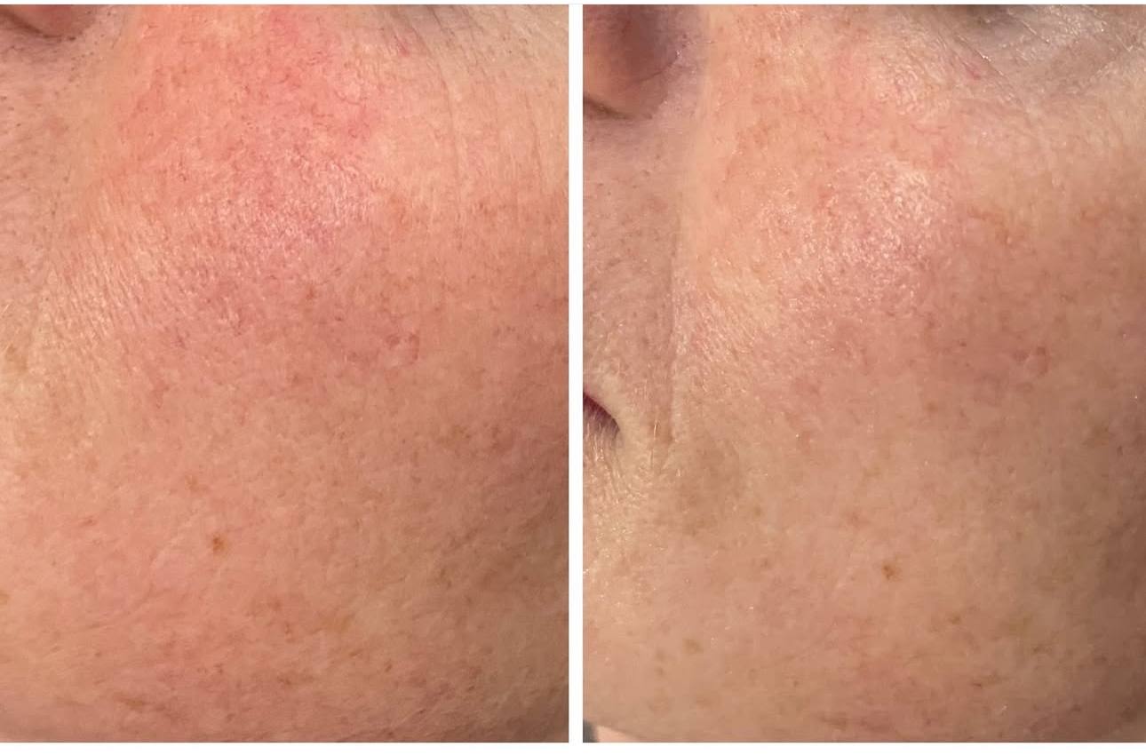 YVETTE Alpin Rose kapiliarus stiprinantis dieninis kremas