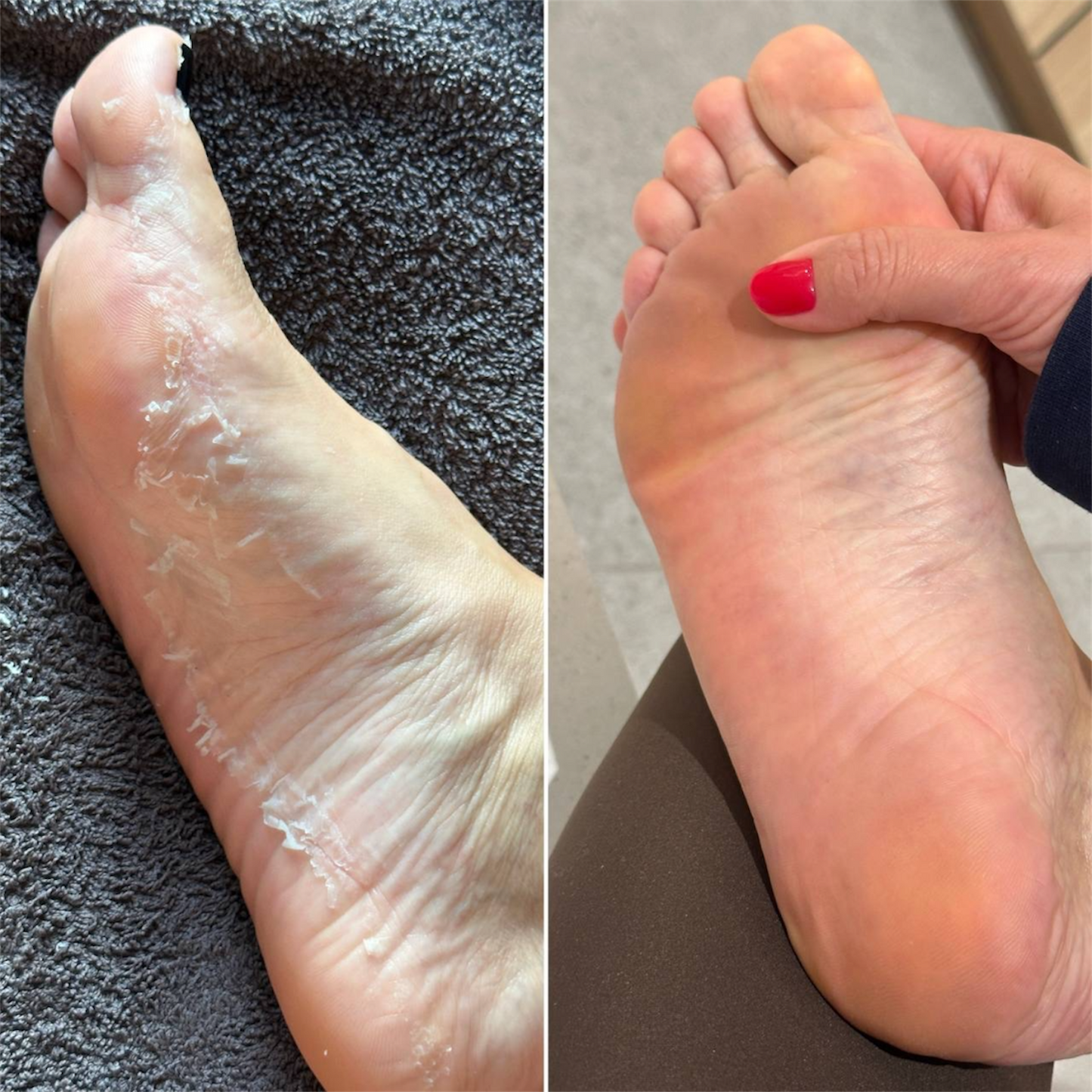 Korėjietiška MONSTER šveičiamoji pėdų kaukė CHAMOS ACACI